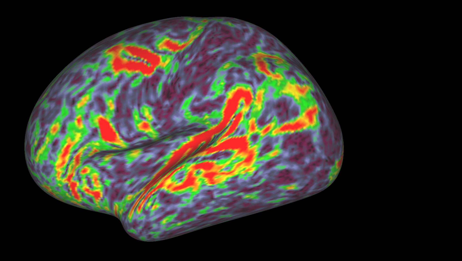 Brain scans look stunning, but what do they actually mean? | Psyche