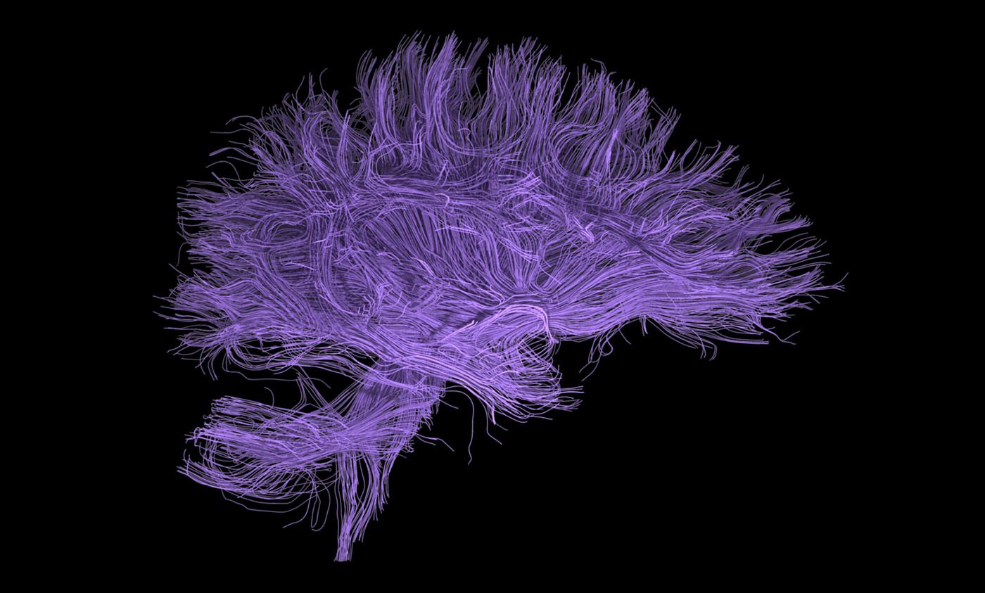 The fugue of life: why complexity matters in neuroscience | Aeon